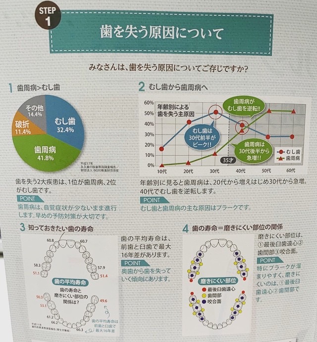 歯を失う原因知ってますか？