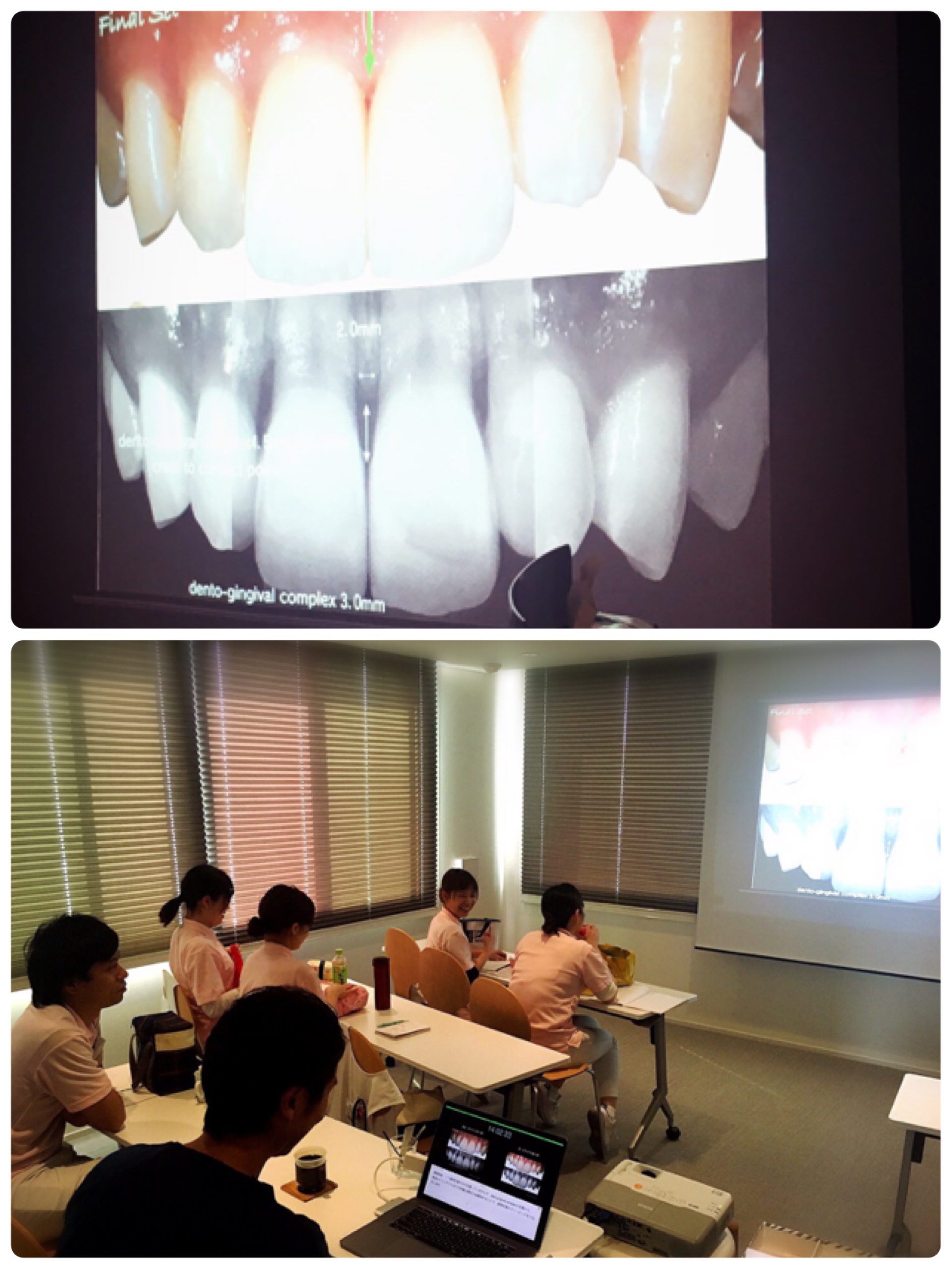 審美歯科について勉強会を開きました！