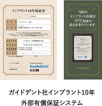 ガイドデント社インプラント10年外部有償保証システム