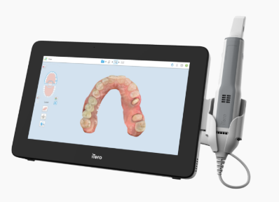iTero Elementとは？歯科矯正の革新的スキャナー完全解説